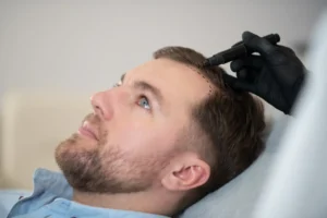 Read more about the article What Should You Know Before Getting an FUE Hair Transplant in Malaysia?